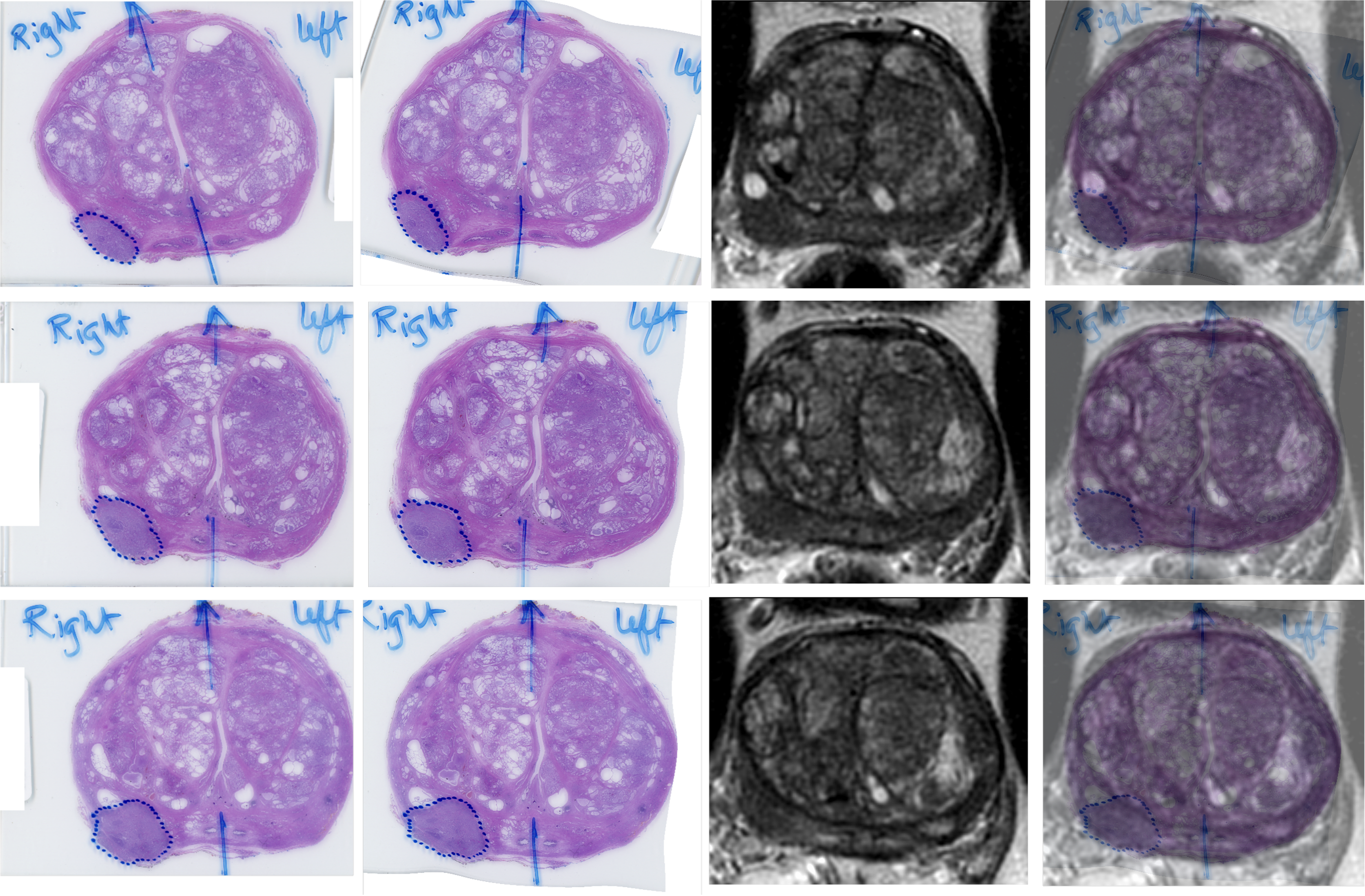 MRI to histopathology registration pipeline